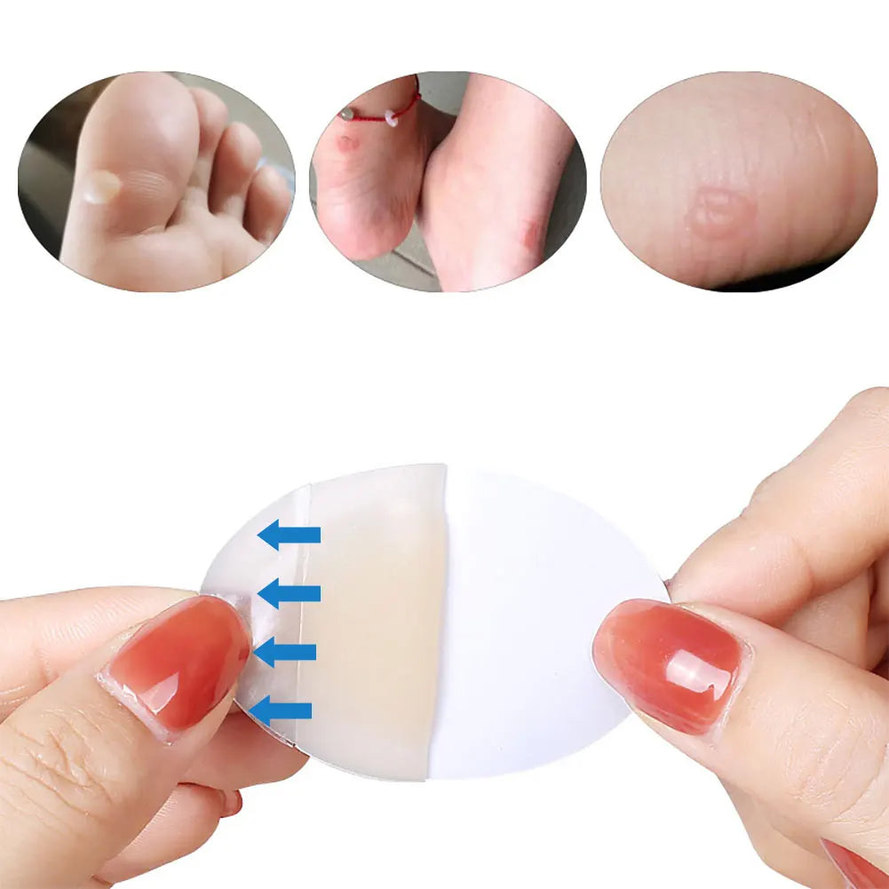 20/10pcs Hydrocolloid Foot Patch Heel Stickers Anti-Wear Band-Aid Adhesive Pain Bandage First Aid Outdoor Camping Emergency Kits